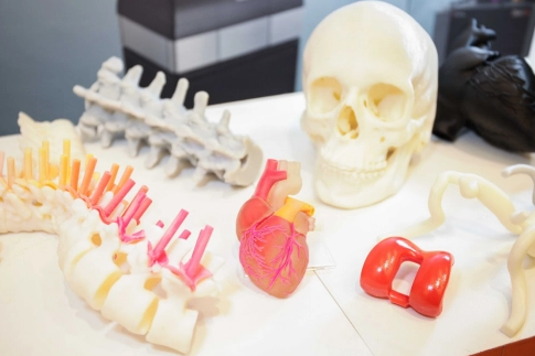 3D打印医疗模型.png